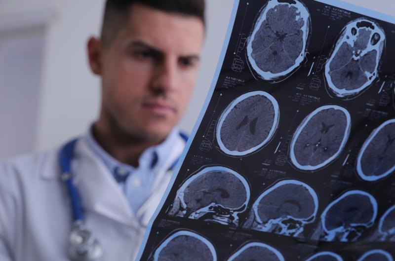 10 potravin, které mohou zmírnit příznaky roztroušené sklerózy