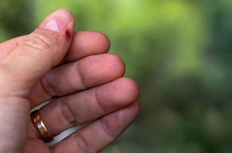 Zbavte se záděrů jednou provždy: Přírodní olej jako tajná zbraň pro zdravé nehty